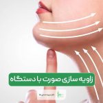 زاویه سازی صورت با دستگاه و مزایا آن