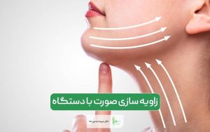 زاویه سازی صورت با دستگاه و مزایا آن