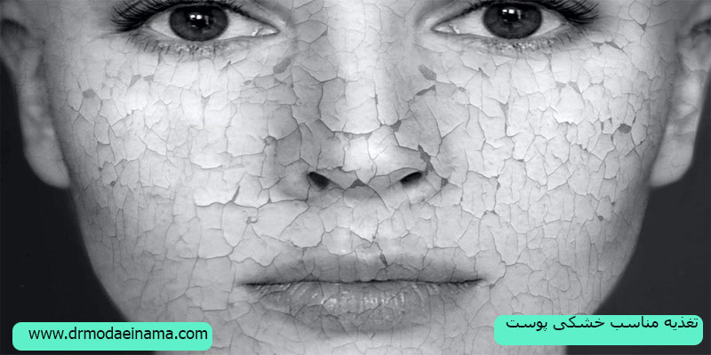 تغذیه-مناسب-برای-خشکی-پوست