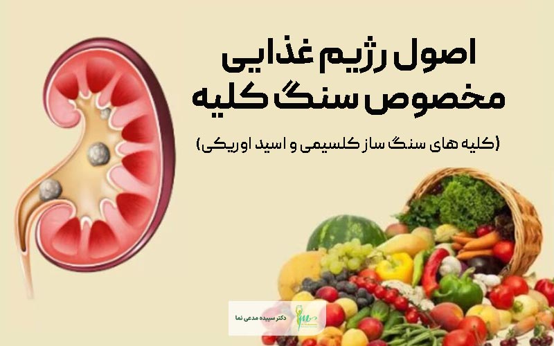 اصول رژیم غذایی مخصوص سنگ کلیه و کلیه سنگ ساز