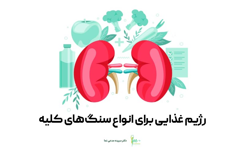 رژیم غذایی برای انواع سنگ های کلیه بدن