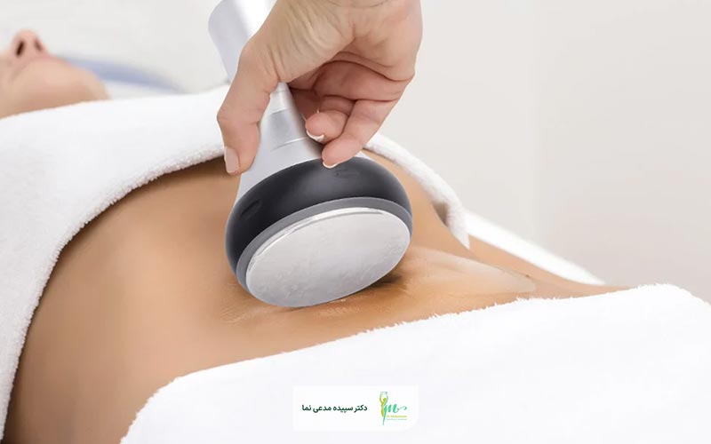 مراقبت های بعد از لاغری با دستگاه