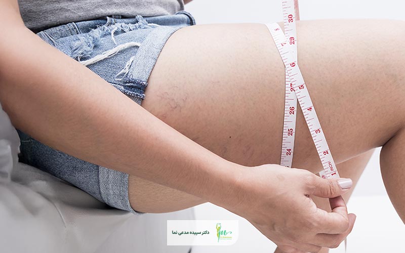 لاغری ران با دستگاه چگونه انجام میشود و چیست