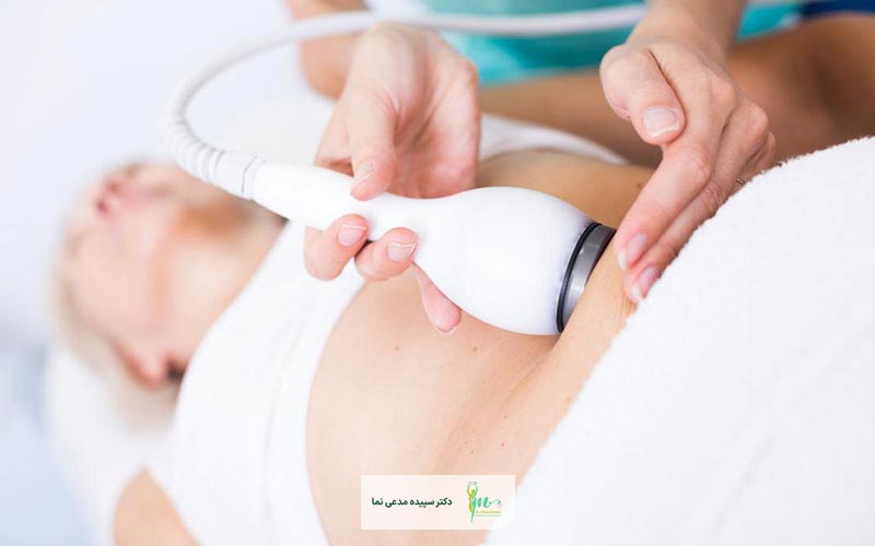 لاغری با دستگاه چیست و چه مزایایی دارد