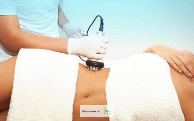 کبودی یا تغییر رنگ موضعی می‌تواند جزو عوارض لاغری با دستگاه باشد