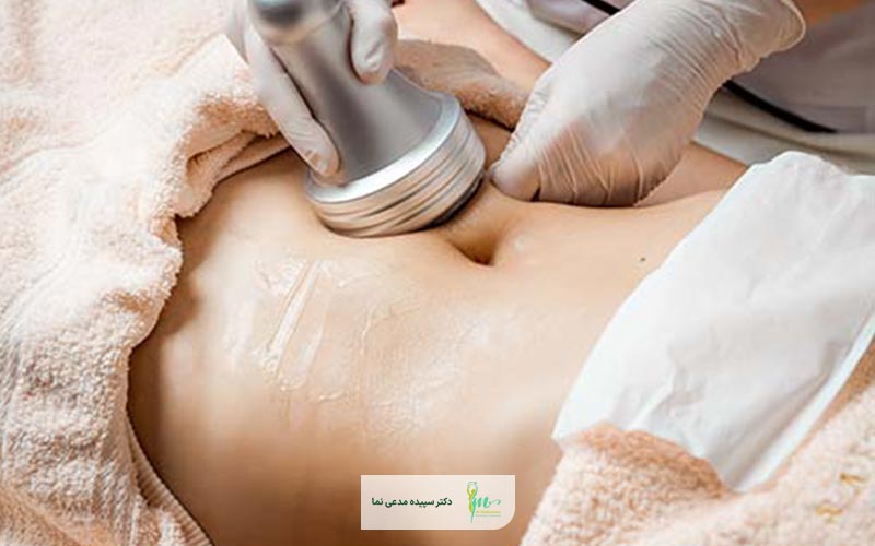 مقایسه دستگاه لاغری شکم اوندا پرو با RF و سایر دستگاه های لاغری شکم