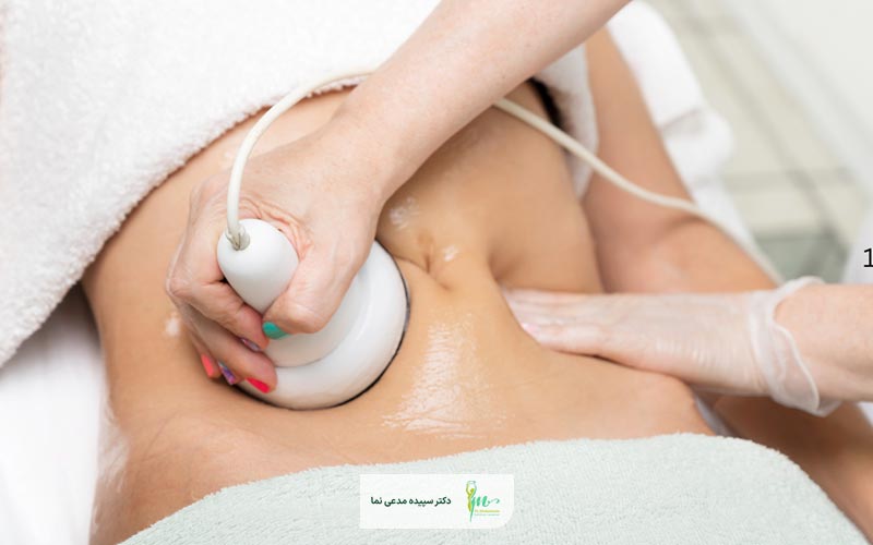 پیکر تراشی بدون جراحی یا غیر جراحی چیست و چه کاربردی دارد