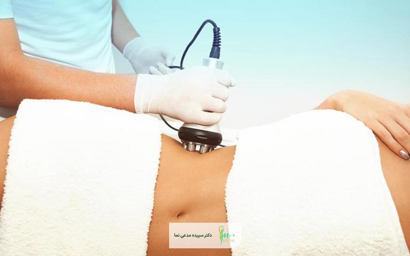 روش های رایج پیکرتراشی بدون جراحی در ایران