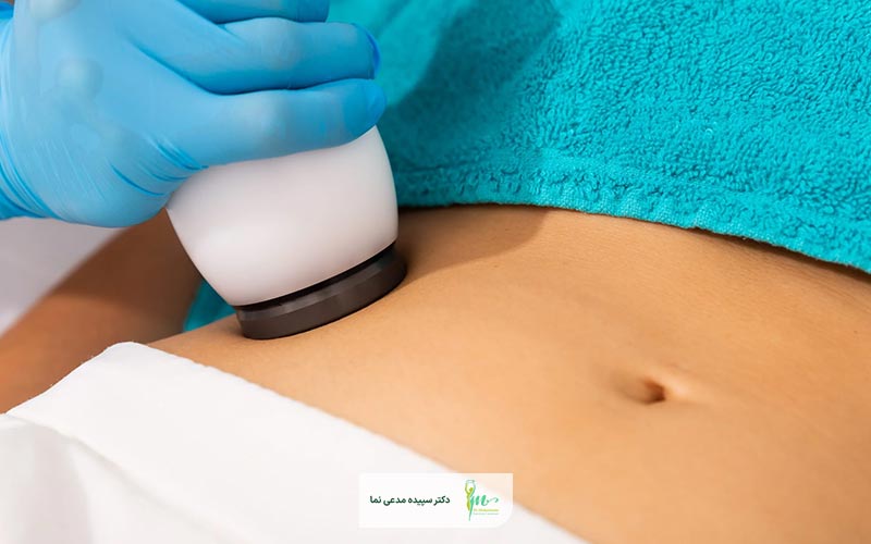 بهترین کاندید برای پیکر تراشی غیر جراحی کیست